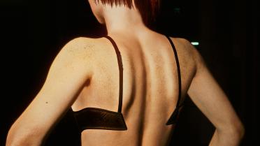 Natural shoulder freckles