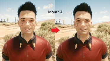 Male V teeth restoration