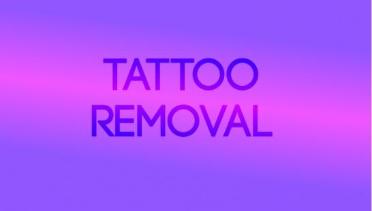 Tattoo removal