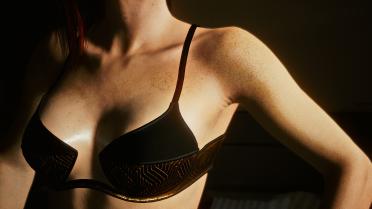 Natural shoulder freckles