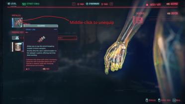 Cancel the prosthetic equipment