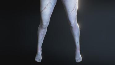 Jill <Mutation> I (Acyclic) Nude Patch