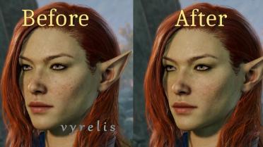 No Elf Freckle - Updated for Launch