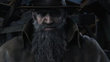 Bitores Mendez - Real Left Eye