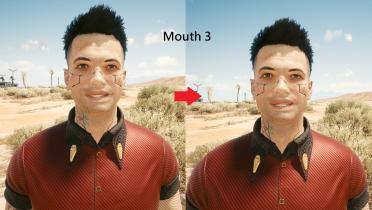 Male V teeth restoration