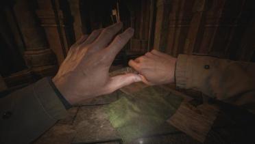 Restoring Ethan's hand