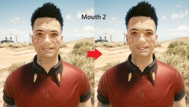 Male V teeth restoration