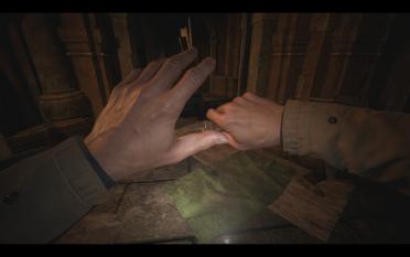 Ethan left hand repair