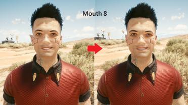 Male V teeth restoration