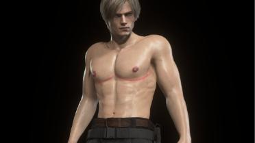 Top Surgery Leon