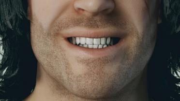 HD Teeth